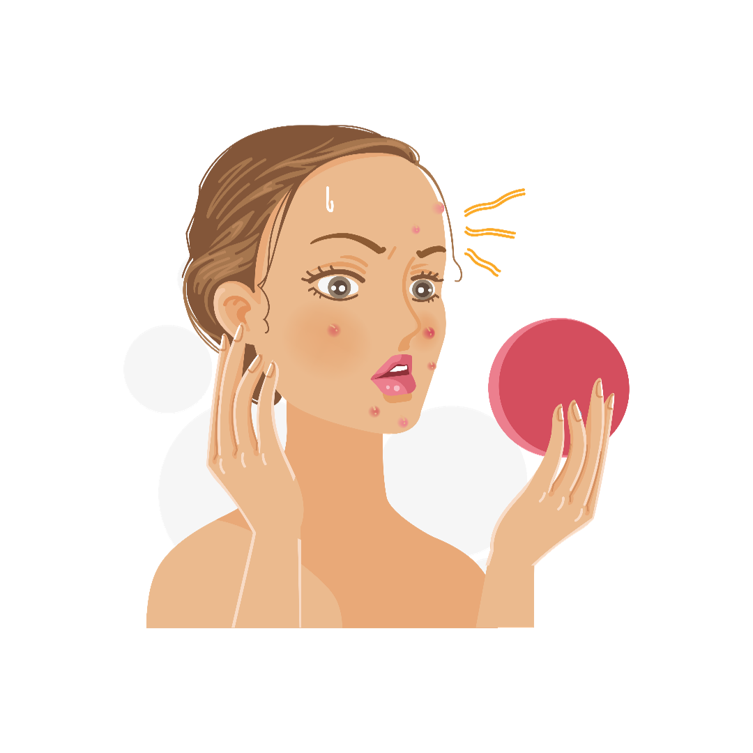 Acne : Prevalence, Impact, and Management